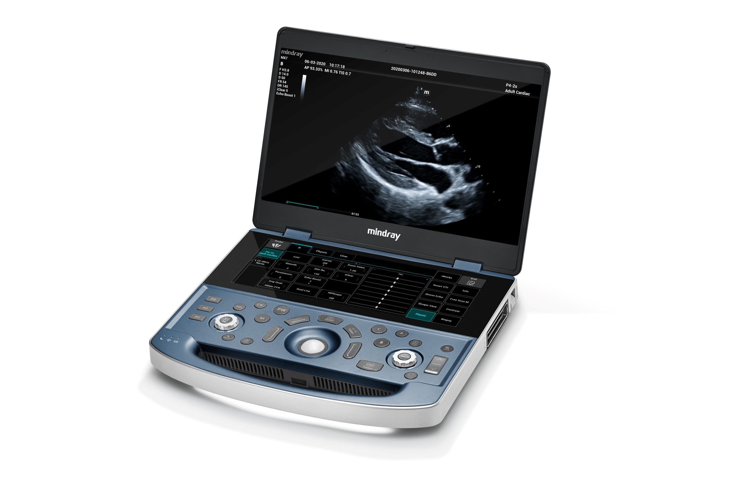 Mindray MX7