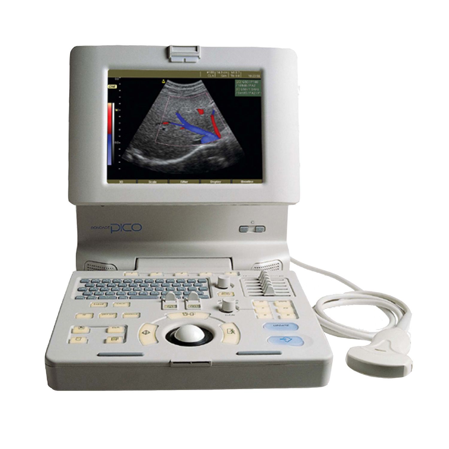 Medison SonoAce Pico