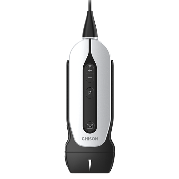 Chison SonoEye P2