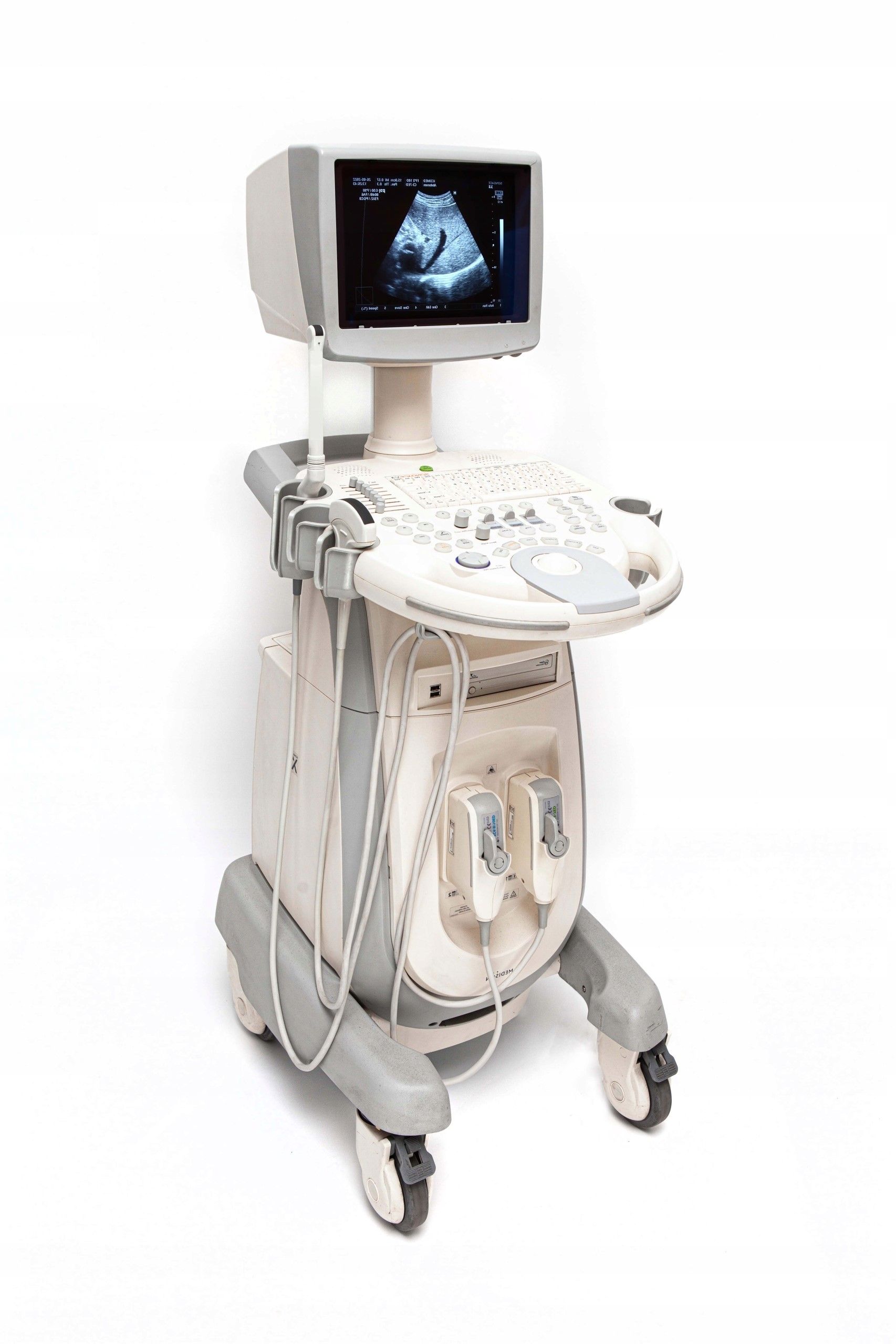 Medison SonoAce X4